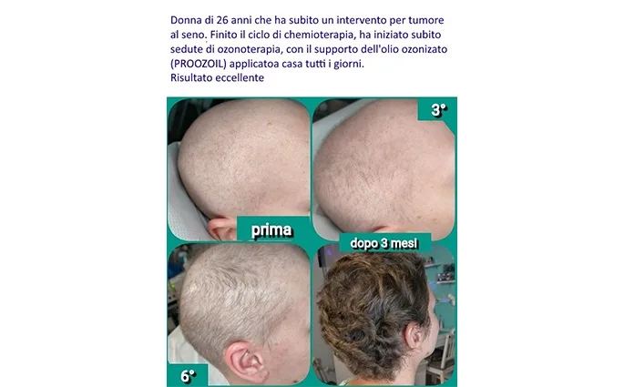 PROO - ESTETICA E BENESSERE