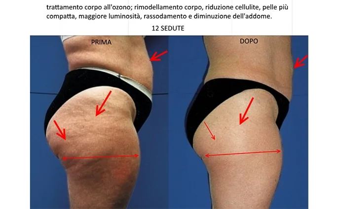 PROO - ESTETICA E BENESSERE
