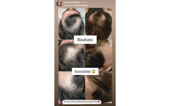 PROO - ESTETICA E BENESSERE