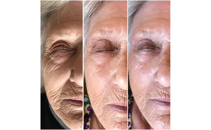 PROO - ESTETICA E BENESSERE