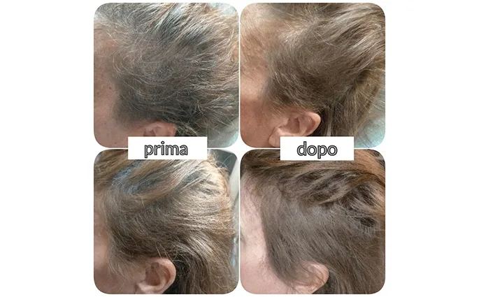 PROO - ESTETICA E BENESSERE