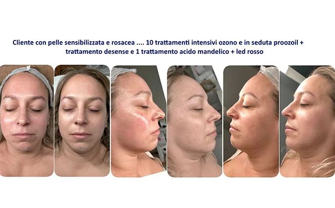 PROO - ESTETICA E BENESSERE