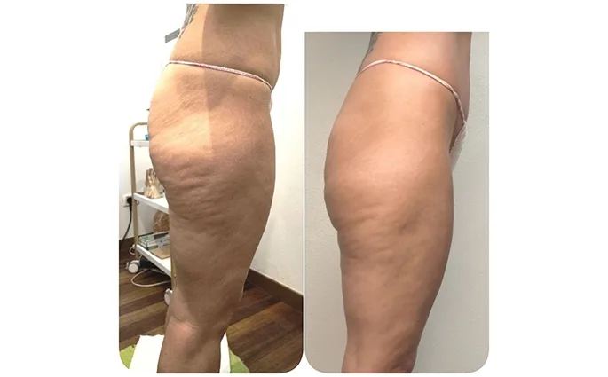 PROO - ESTETICA E BENESSERE