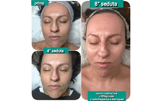 PROO - ESTETICA E BENESSERE