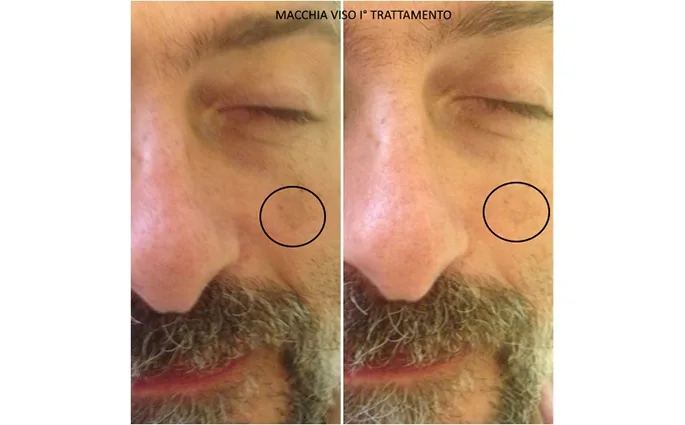 PROO - ESTETICA E BENESSERE
