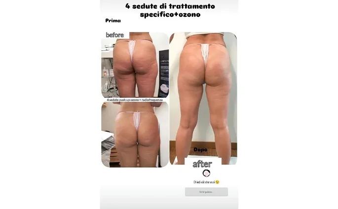 PROO - ESTETICA E BENESSERE