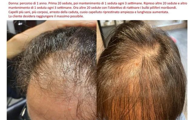 PROO - ESTETICA E BENESSERE