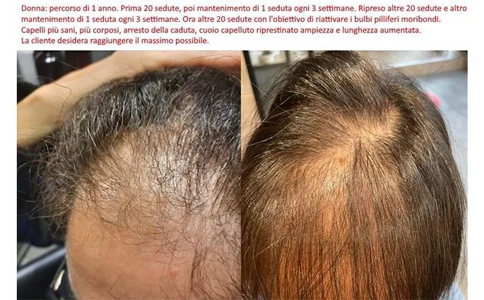 PROO - ESTETICA E BENESSERE