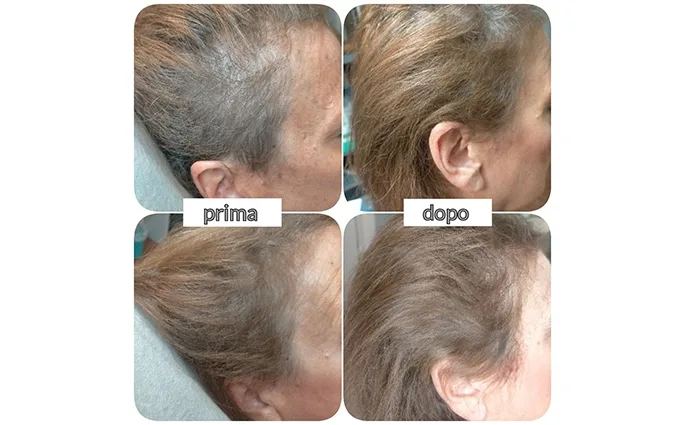 PROO - ESTETICA E BENESSERE