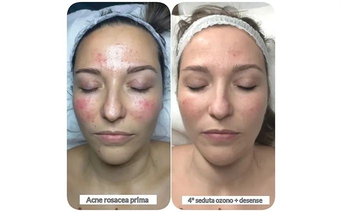 PROO - ESTETICA E BENESSERE