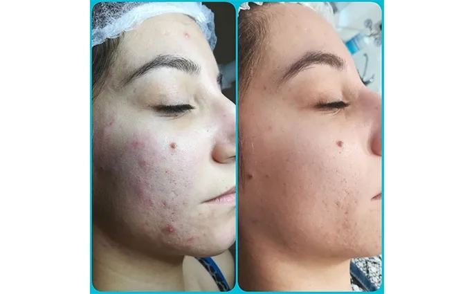 PROO - ESTETICA E BENESSERE