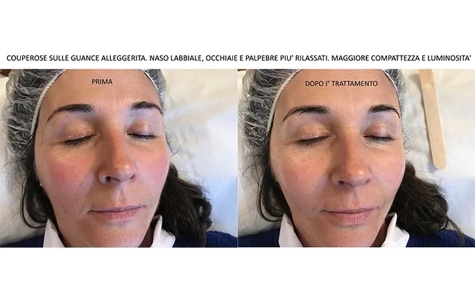 PROO - ESTETICA E BENESSERE