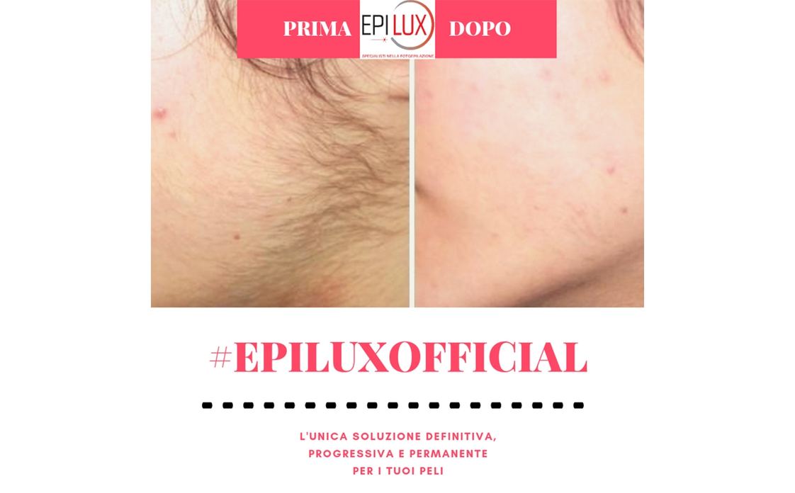 EPILUX - BIOTECHNO Srl