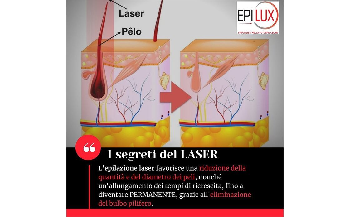 EPILUX - BIOTECHNO Srl