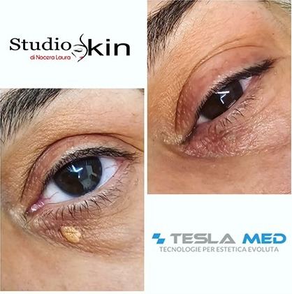 STUDIO SKIN Dermopigmentazione Estetica Avanzata