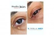 STUDIO SKIN Dermopigmentazione Estetica Avanzata