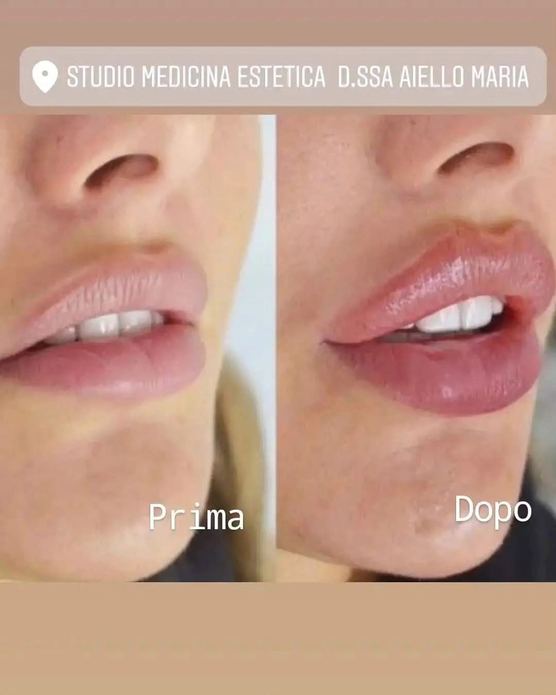 Dott.ssa Maria Aiello Medicina Estetica E Medico Competente Sicurezza Sul Lavoro